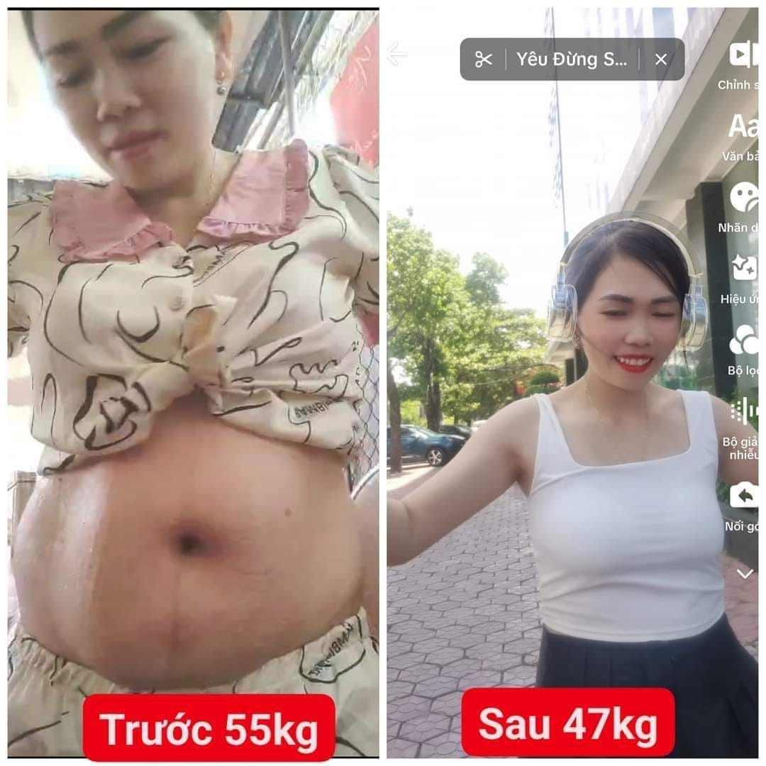 Giảm mỡ bụng sau sinh