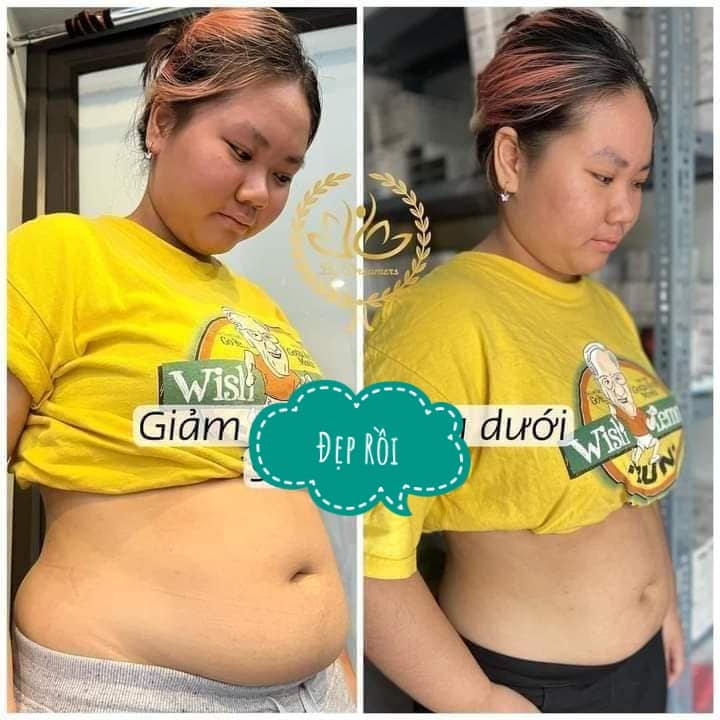 Giảm mỡ bụng cho nữ