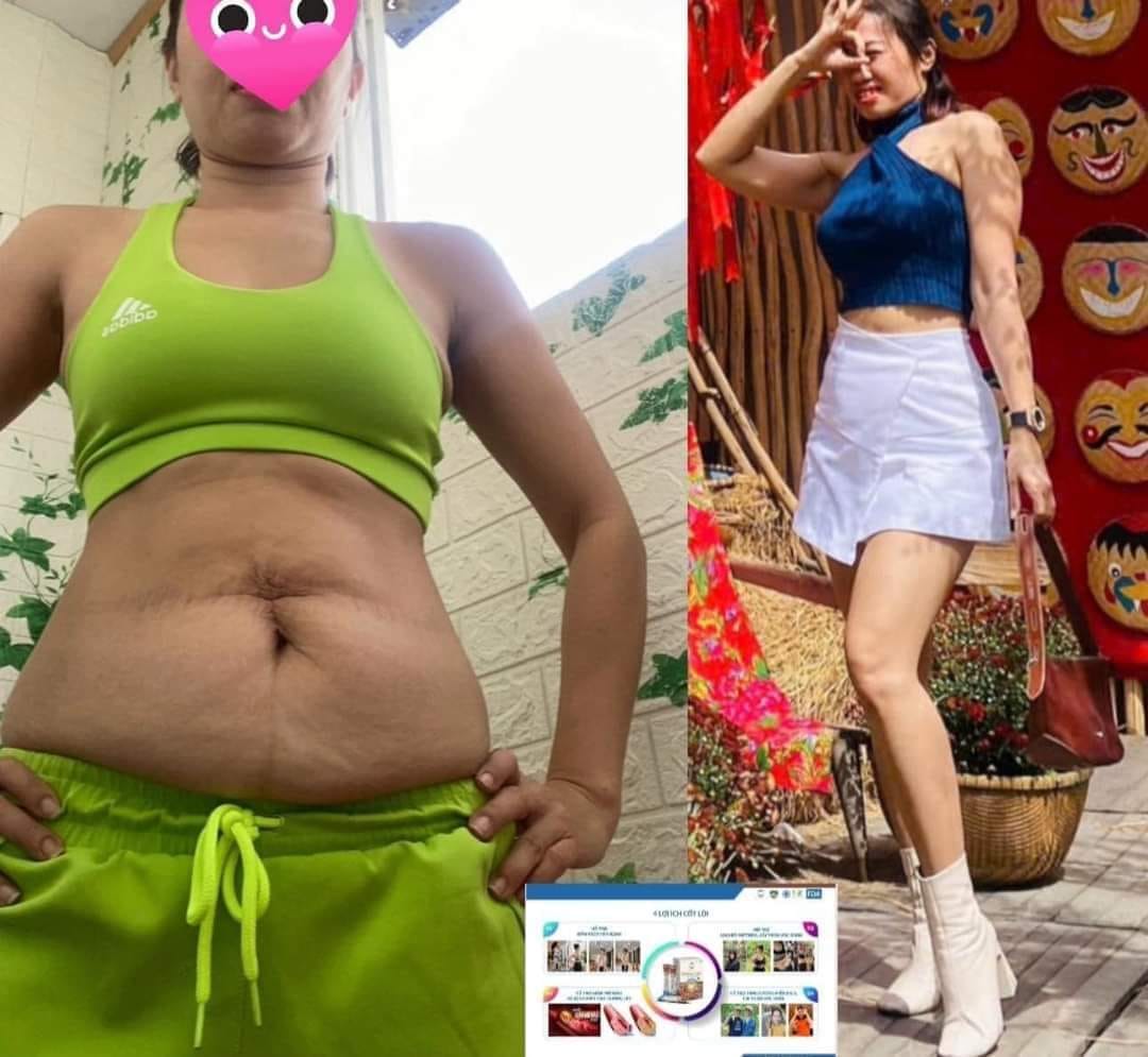 Mỡ bụng khiến chị em kém dấp dẫn