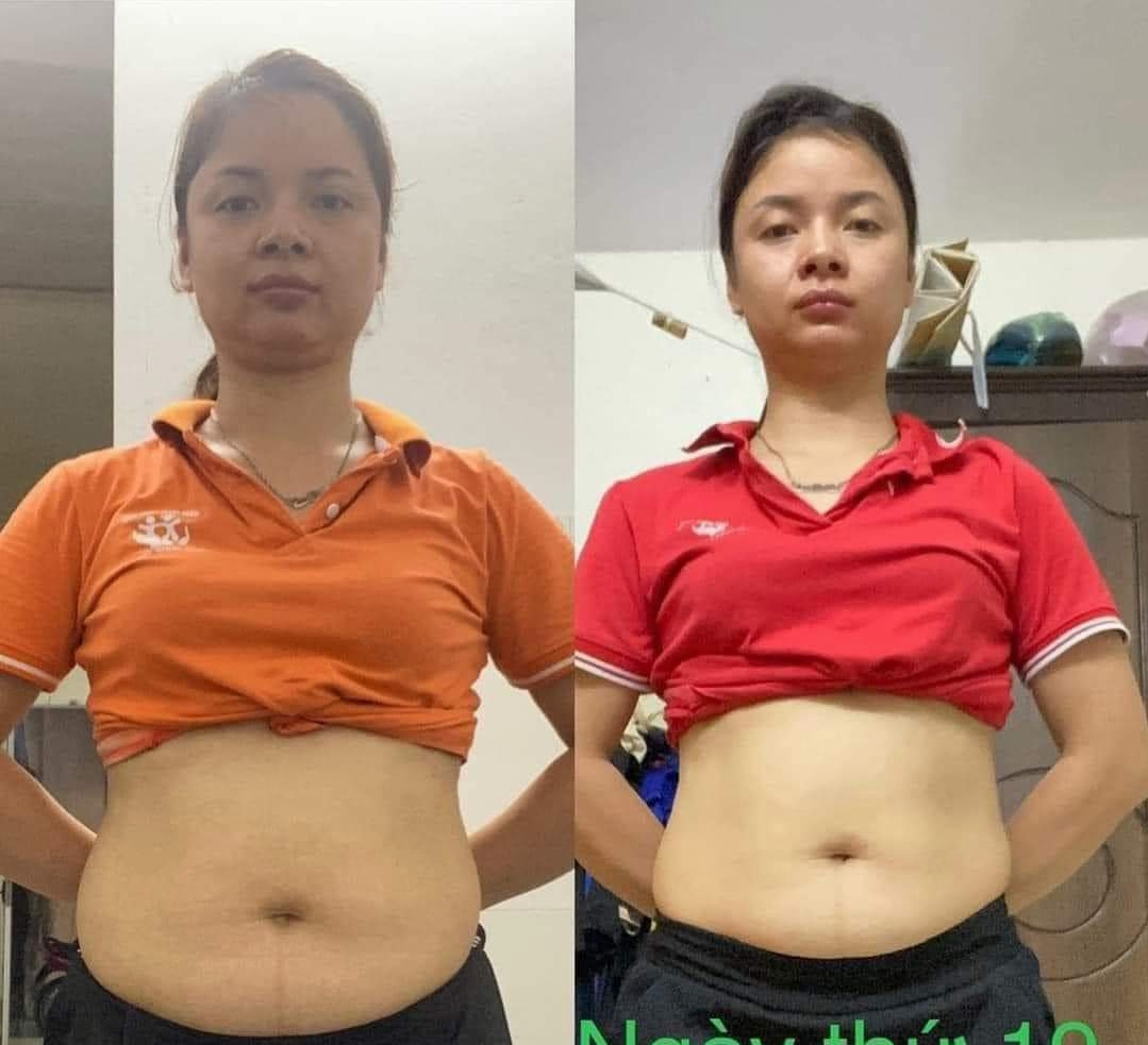 Combo giảm mỡ mặt, mỡ bụng