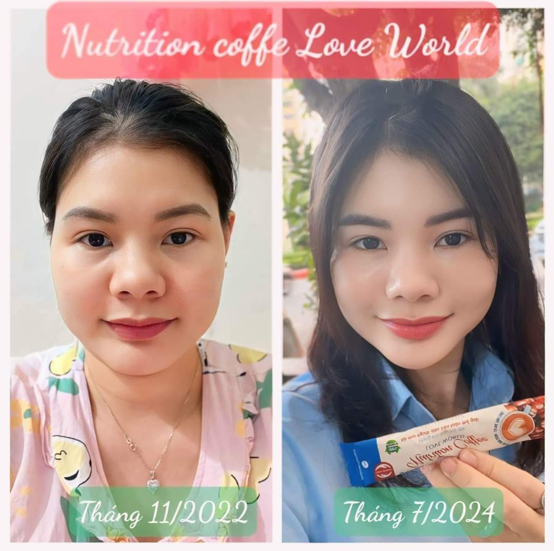 Cách giảm mỡ mặt đơn giản