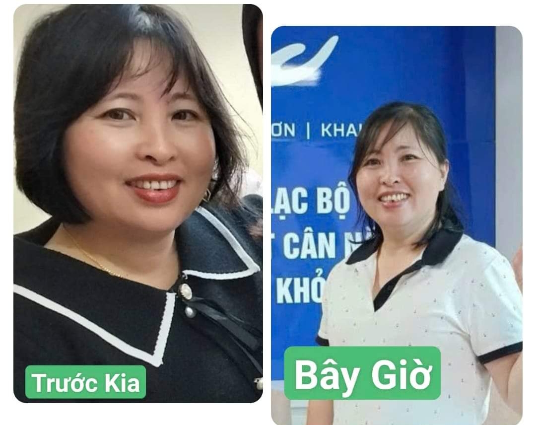 cách giảm mỡ khuôn mặt