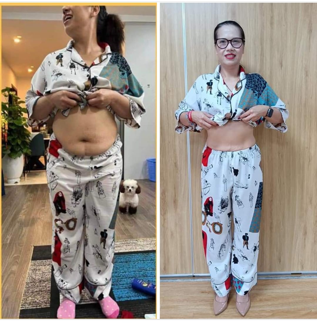 Chị Hân giảm 54cm vòng bụng